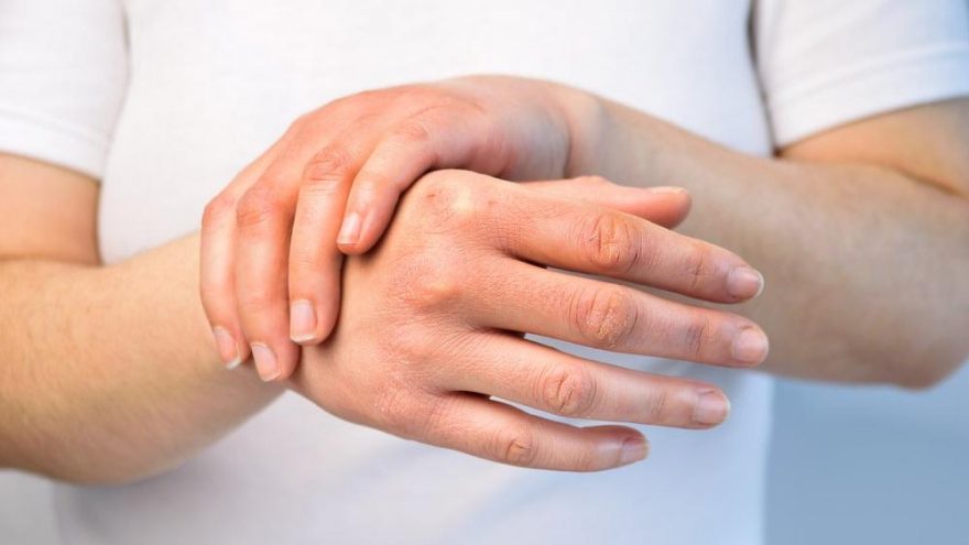 Kurumuş Eller İçin Maske Tarifi